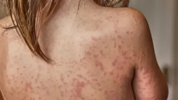SAÚDE